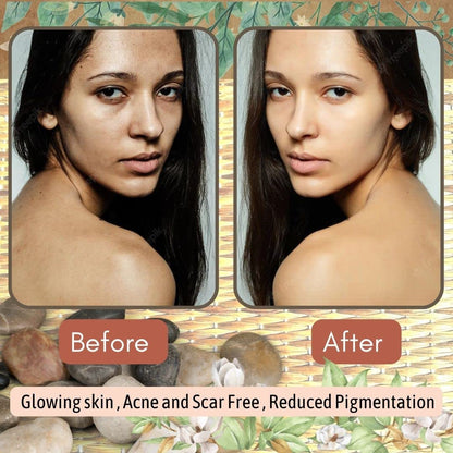 Multani Mitti Powder (Fuller's Earth) for Face, Skin & Hair - 100g